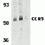 Western blot analysis of CCR3 in human spleen tissue lysates with CCR3 antibody at 1 (lane 1) and 2 μg/mL (lane 2), and 2 μg/mL in the presence of blocking peptide. (1105P) (lane 3).<br><br> <b>Below:</b> Immunohistochemistry of CCR3 in human spleen tissue with CCR3 antibody at 10 μg/mL.