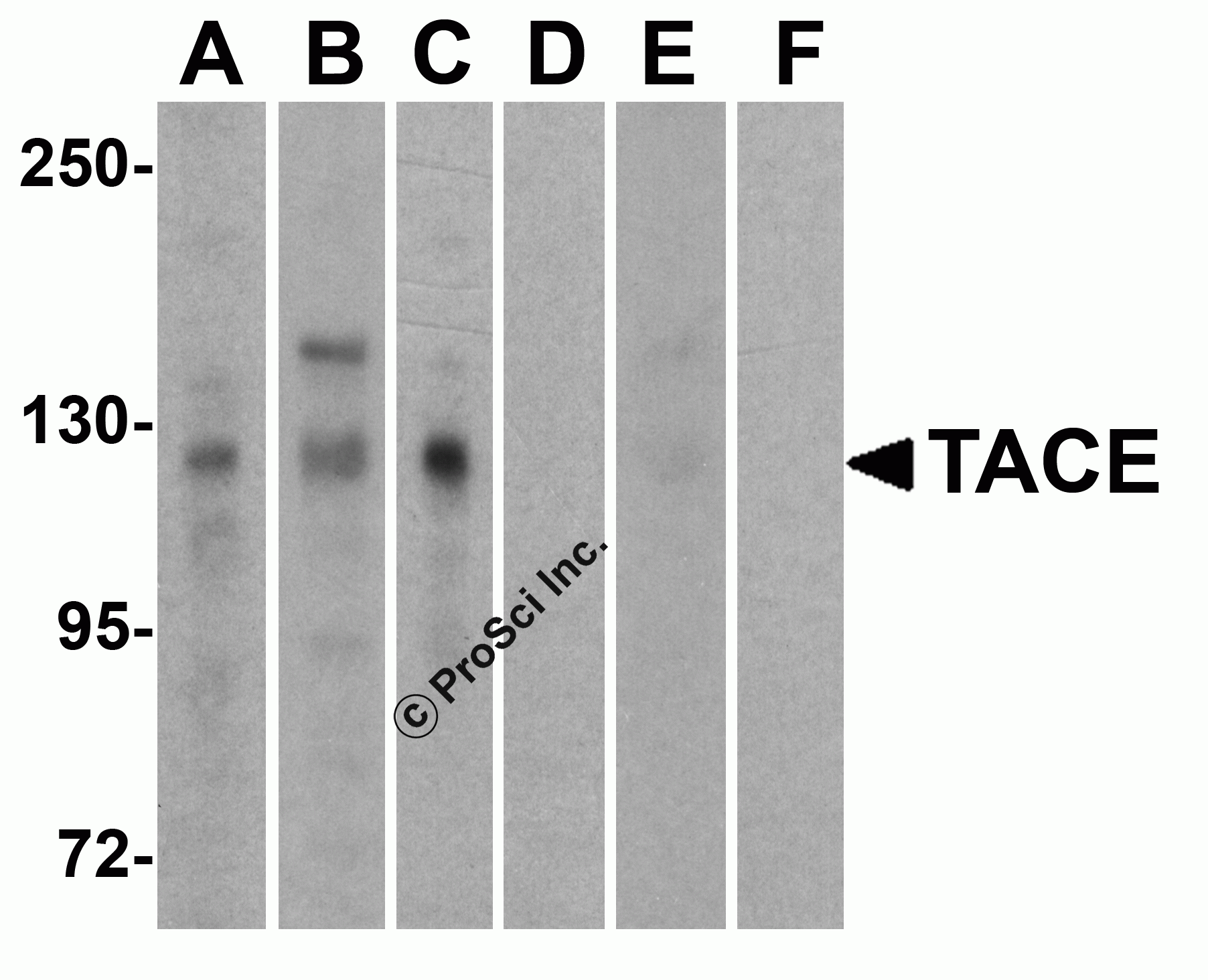 TACE Peptide