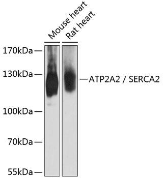 ATP2A2 / SERCA2 Antibody