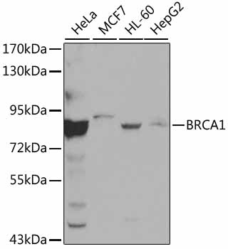 BRCA1 Antibody
