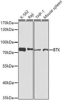 BTK Antibody [9D11A9]