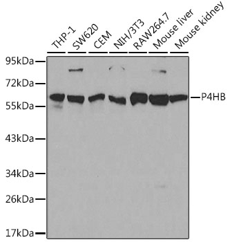 P4HB Antibody, KO Validated