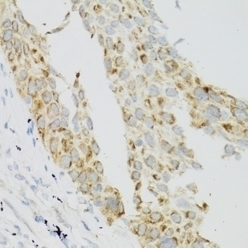 TEK Antibody