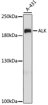 ALK Antibody