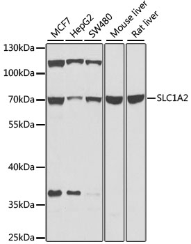 SLC1A2 Antibody