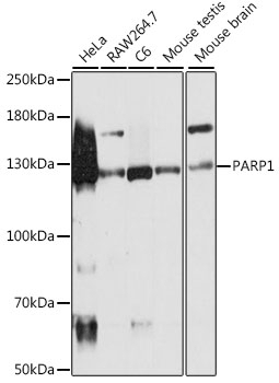 PARP1 Antibody, KO Validated