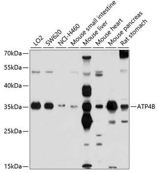 ATP4B Antibody