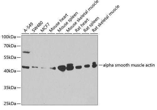 alpha smooth muscle actin Antibody