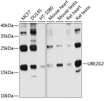 UBE2G2 Antibody