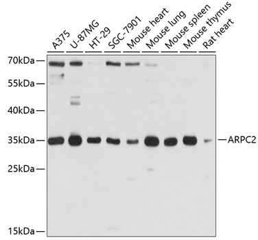 ARPC2 Antibody