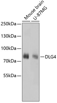 DLG4 Antibody [D5E5]