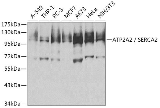 ATP2A2 / SERCA2 Antibody