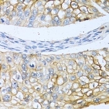BMP4 Antibody