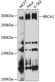 BRCA1 Antibody