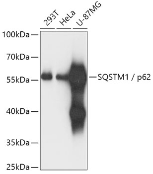 SQSTM1 / p62 Antibody, KO Validated