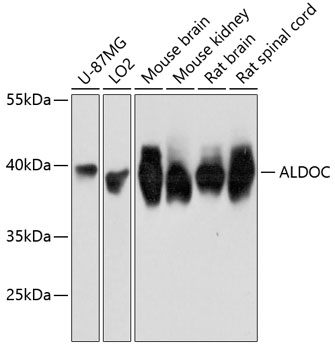 ALDOC Antibody