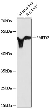 SMPD2 Antibody