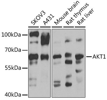 AKT1 Antibody