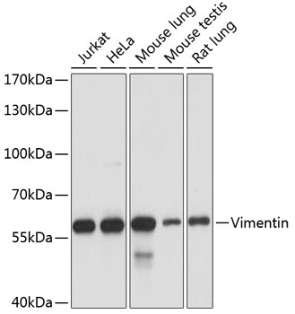 Vimentin Antibody, KO Validated
