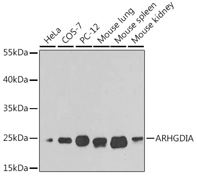ARHGDIA Antibody, KO Validated
