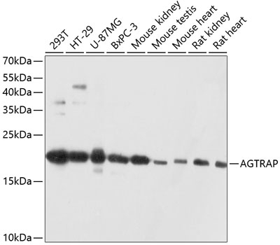 AGTRAP Antibody