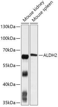 AMPK alpha 1 Antibody