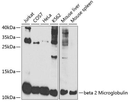 beta 2 Microglobulin Antibody, KO Validated