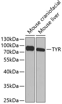 TYR Antibody