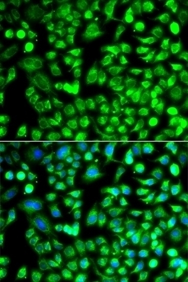ALKBH4 Antibody
