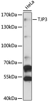 TJP3 Antibody