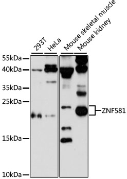 ZNF581 Antibody
