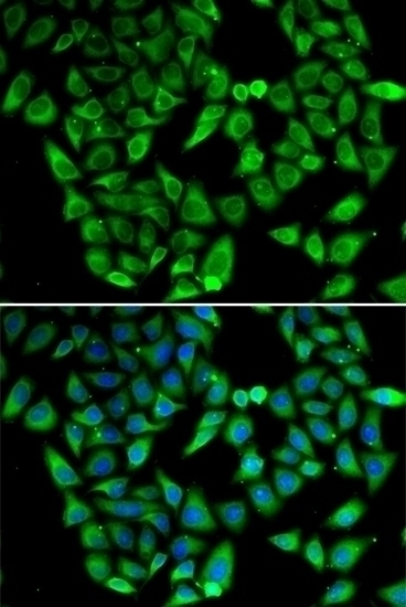 ASIP Antibody