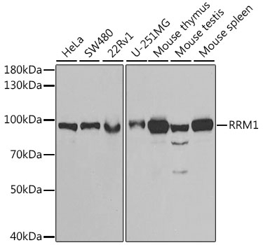 RRM1 Antibody