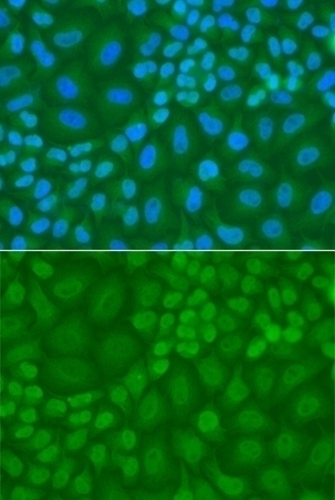 TDG Antibody