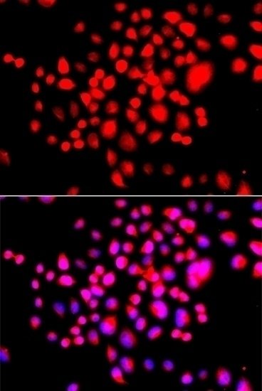 STK19 Antibody