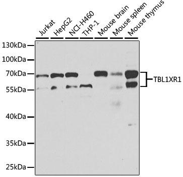 TBL1XR1 Antibody