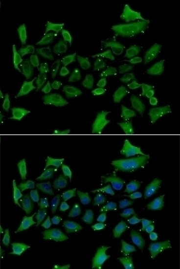 ALAS1 Antibody