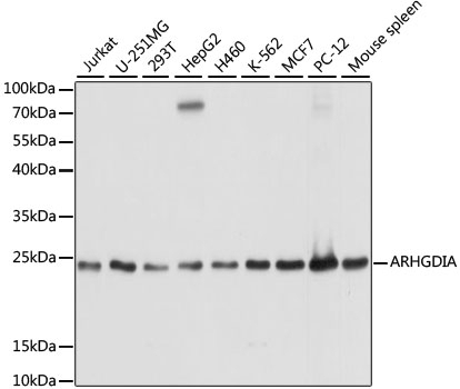 ARHGDIA Antibody