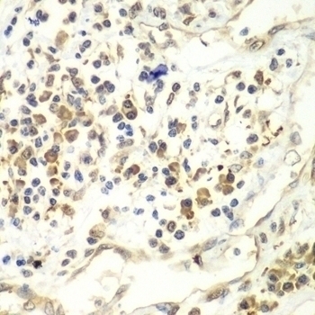 UPF1 Antibody