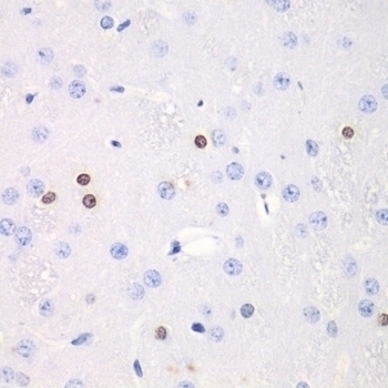 TKT Antibody