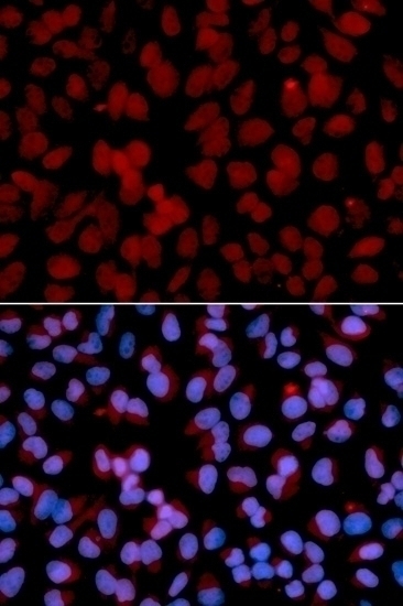 TNFAIP3 Antibody