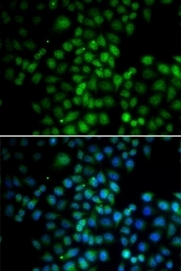 C11orf30 Antibody