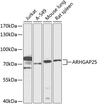 ARHGAP25 Antibody