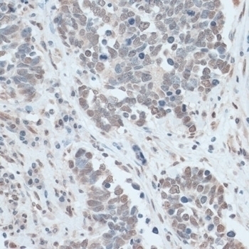 ZNF707 Antibody