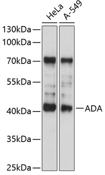 ADA Antibody