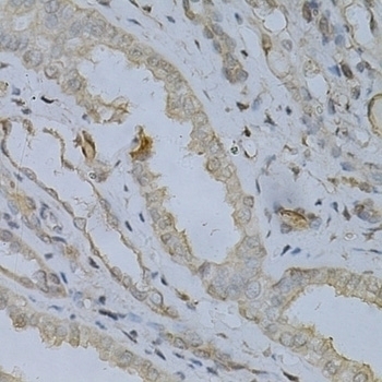 ACADM Antibody