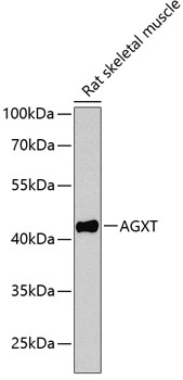 AGXT Antibody