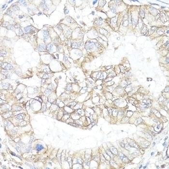 ATP1B1 Antibody