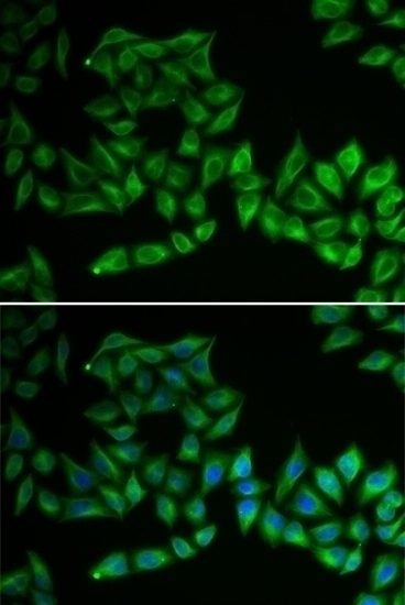 TPMT Antibody