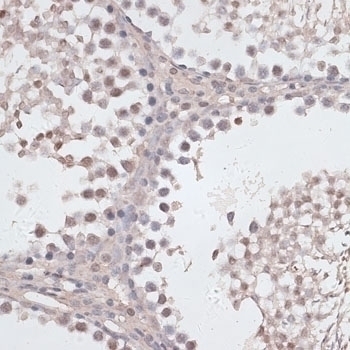 CCNE2 Antibody